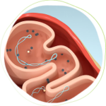 3D illustration of a section of the human gut, showing black and blue microorganisms, highlighting the concept of the metabolic health.