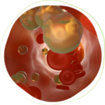 Illustration of a human artery interior showing red blood cells and yellowish cholesterol plaques against vessel walls, depicting artery health.